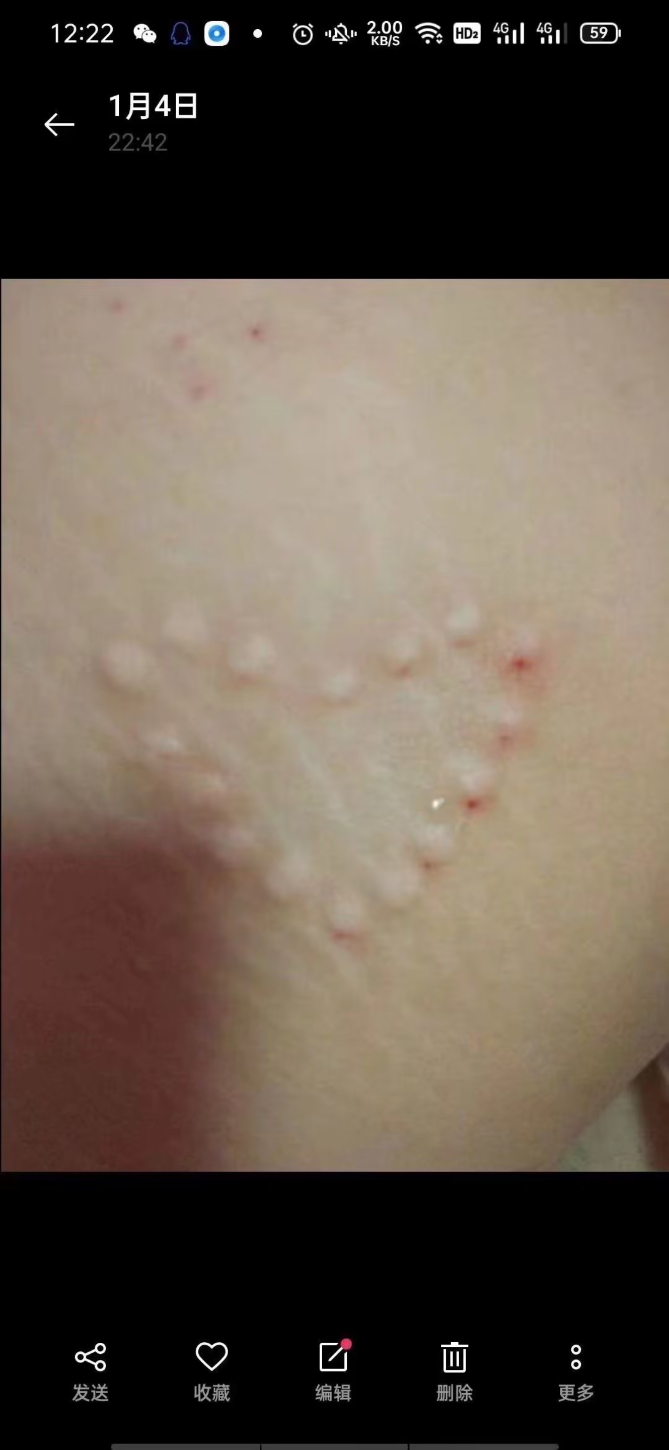 皮试调教