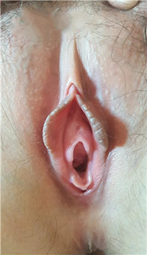 废物母畜
